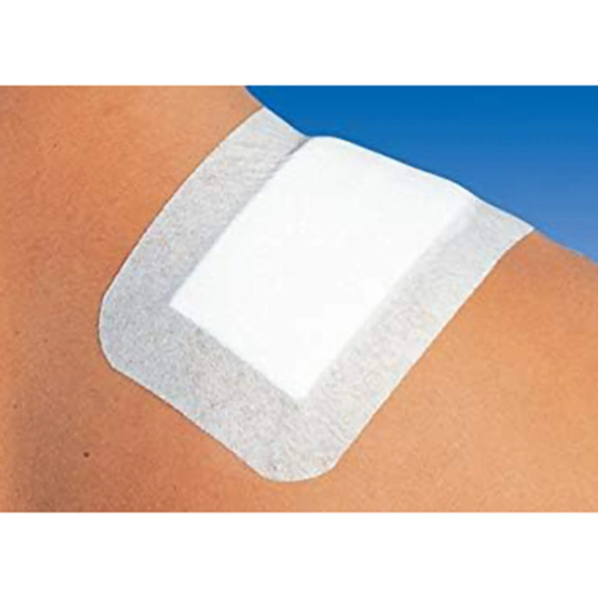 Cosmopor® White Adhesive Dressing, 3-1/8 x 4 Inch Cosmopor® Steril