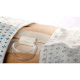 Cath-Secure™ Holder, Tube Cath-Secure™