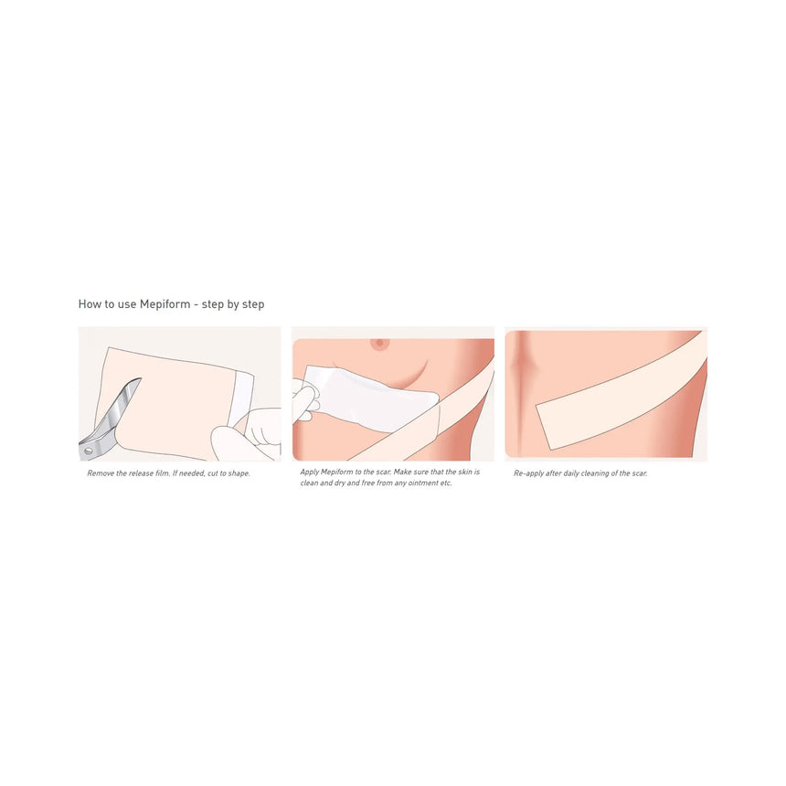 Mepiform® Self Adherent Silicone Dressing, 2 x 3 Inch Mepiform®