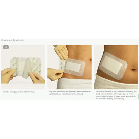 Mepore® Adhesive Dressing, 2½ x 3 Inch - getMovility