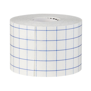 McKesson Nonwoven Fabric / Printed Release Paper Dressing Retention Tape, 2 Inch x 10 Yard, White McKesson